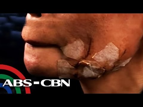 Nangagat na pusa, aso nagbunsod ng takot sa 'aswang'