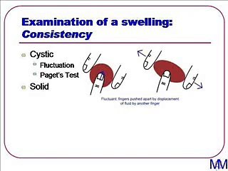 Introduction to Clinical Surgery Lectures - 03 Swellings