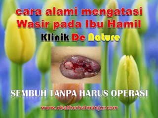 cara alami mengatasi wasir pada ibu hamil