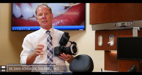 Intraoral Dental Photography [Pt 2.  Full Face Views]