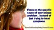 no more dry scalp - dandruff treatment - home remedies for dandruff