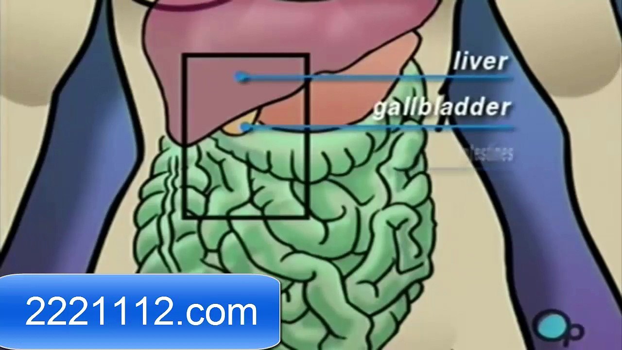 Gallbladder Removal Laparoscopic Surgery