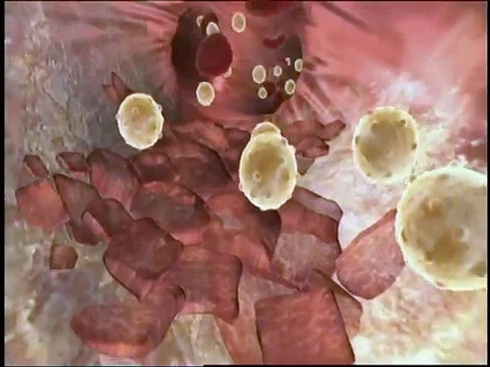 UMA VIAGEM VASCULAR - COLESTEROL - HDL - LDL - ATEROSCLEROSE