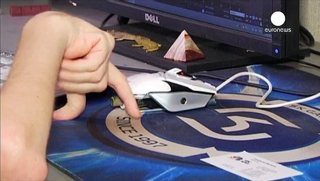 Итальянский нейрохирург готов провести первую в мире операцию по пересадке головы