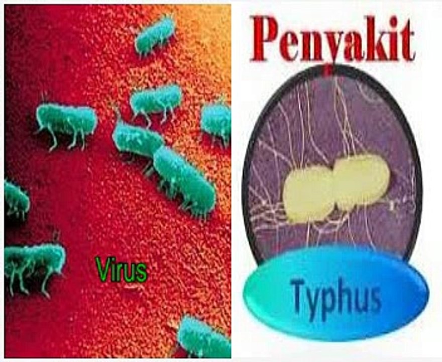 Pengobatan Penyakit Typus