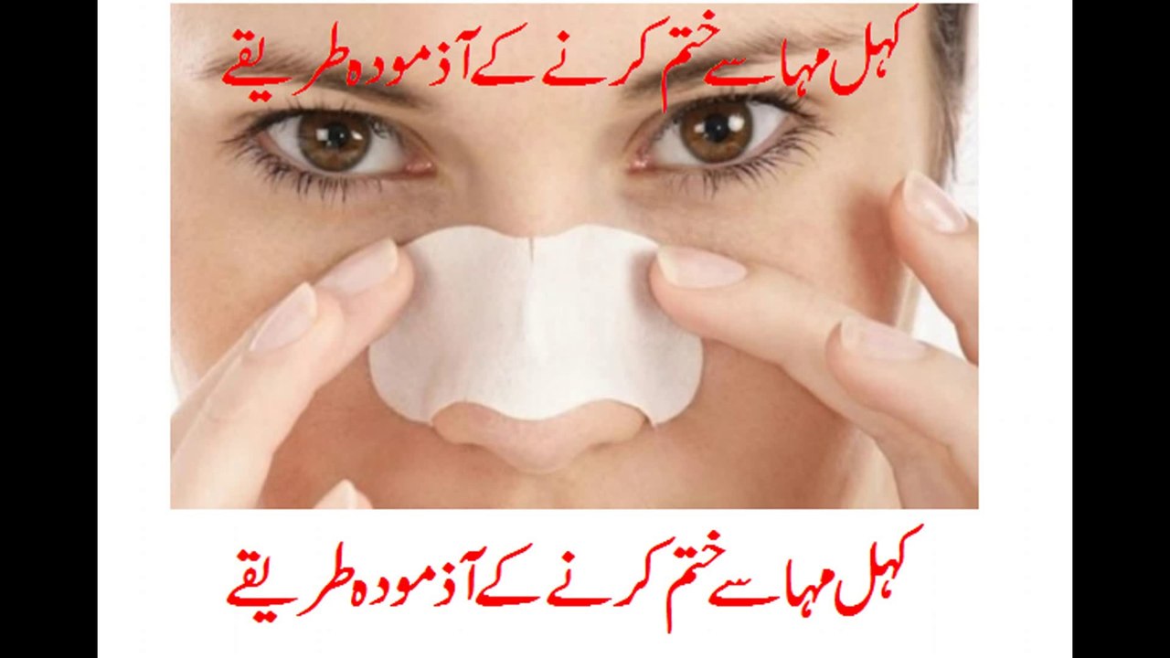 How to remove blackheads