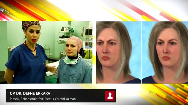 Op. Dr. Defne Erkara botox hakkında bilgiler veriyor...