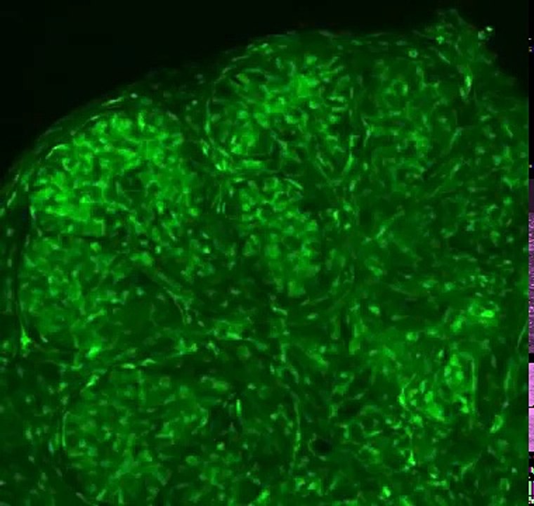 Overview of gland