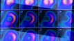 Nuclear Cardiac Imaging - Nuclear Medicine