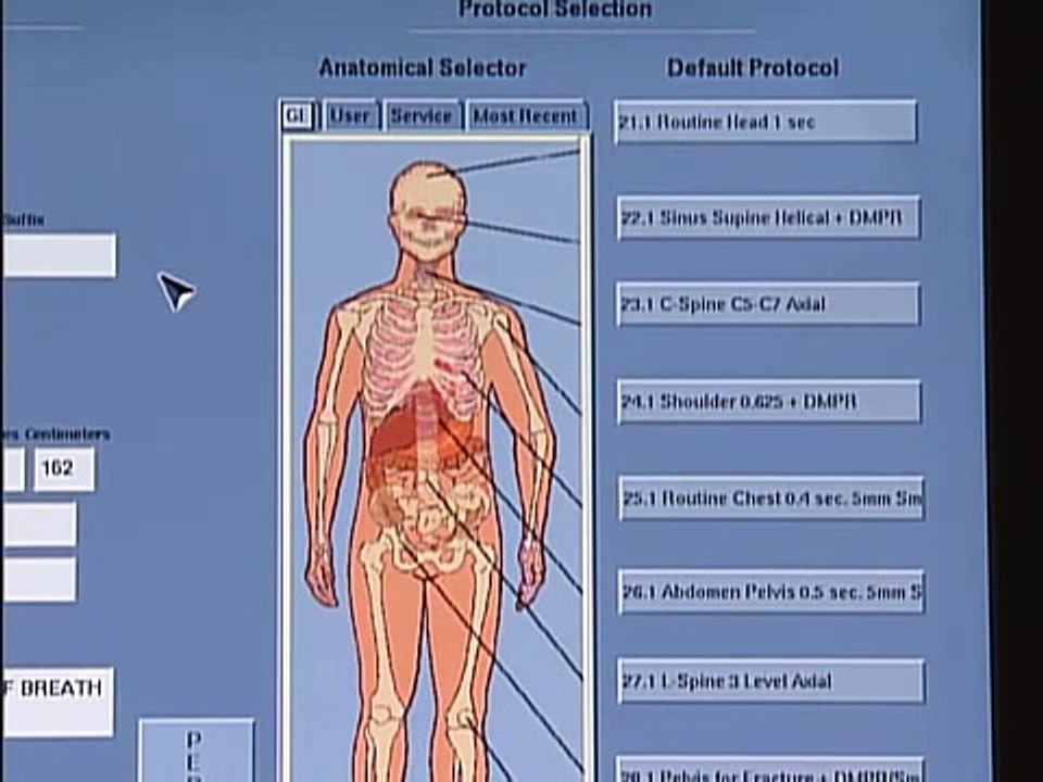 Setting Up a CT Scan