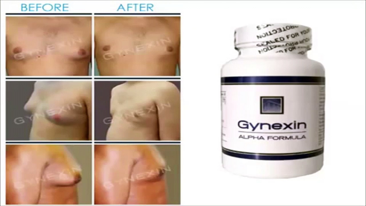 Gynexin Reviews - Best Gynecomastia Treatment Without Surgery