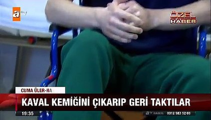 Kanserli kaval kemiğini çıkarıp Radyoterapi yapıp yerine taktılar
