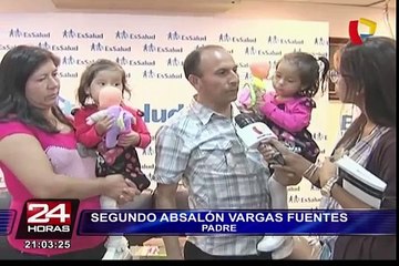 Sandia y Shandel: La siamesas que lograron sobrevivir tras ser separadas