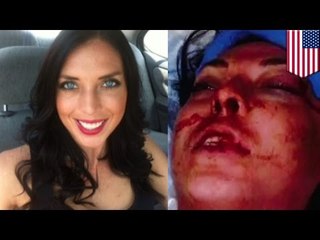 VIOLENCE POLICIÈRE: Des officiers arrêtent un mannequin et lui brise les os du visage