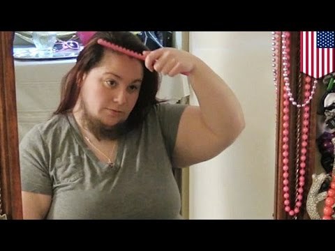 Une femme à barbe, considère se raser pour la première fois depuis des années.