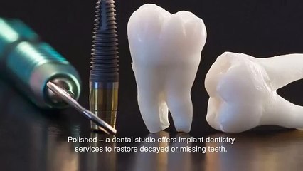 Dental Implants Chicago | Polished - A dental studio