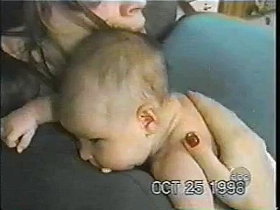 Kotzende Babys