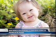 Bebé modelo con sindrome de down revoluciona las pasarelas del mundo