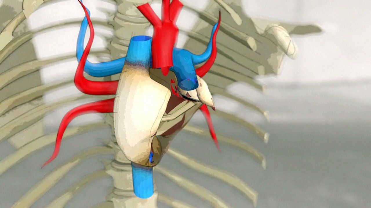 Artificial hearts