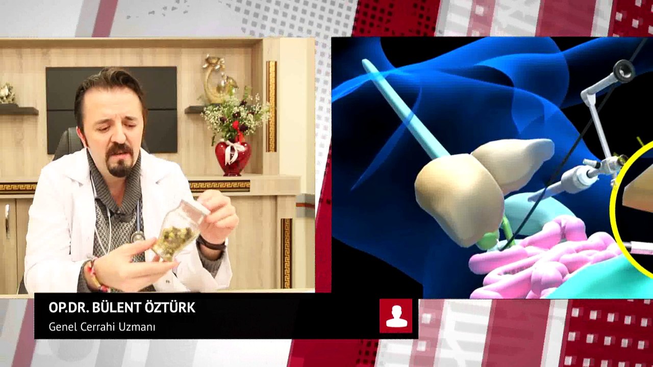Op.Dr.Bülent ÖZTÜRK - Genel Cerrahi Uzmanı  - Safra Kesesi Hastalıkları ve Ameliyatları Hakkında Bilgiler Veriyor ...
