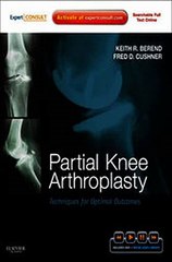 Download Partial Knee Arthroplasty Ebook {EPUB} {PDF} FB2