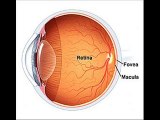 retina tedavisi, retina hastalıkları, retina göz, retinada yırtılma, retina dekolmanı,