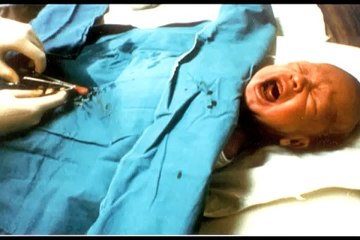 Circumcision is Mutilation