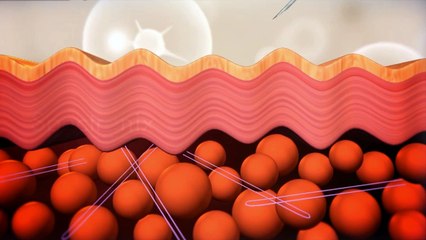 Defy Aging with Micro - Life Threads