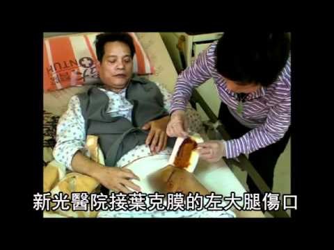健檢休克枉挨刀 昏迷7天險辦喪事 2011.04.27