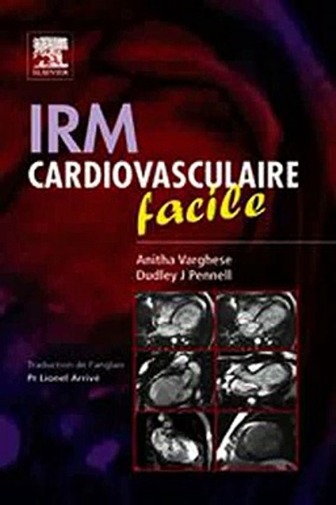 Download IRM cardiovasculaire facile Ebook {EPUB} {PDF} FB2