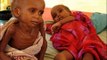 Children in Africa are Starving to Death