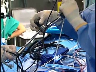 Removing Large Brain Tumor Endoscopically - Dr. Theodore H. Schwartz