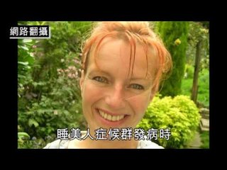 NMA 2010.07.05  動新聞  英女患怪病 瘋狂嘿咻150男