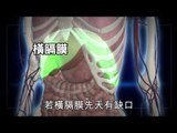 NMA 2010.01.16 動新聞  久咳不癒 原是小腸跑到肺