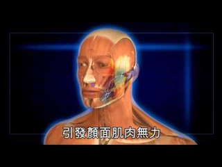 NMA 2009.12.20 動新聞 天冷染病毒 臉歪嘴斜