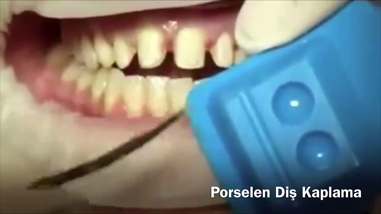 ankara-dis
