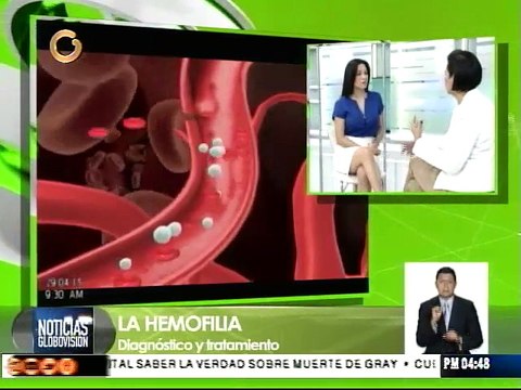 Hemofilia es hereditaria y afecta a hombres