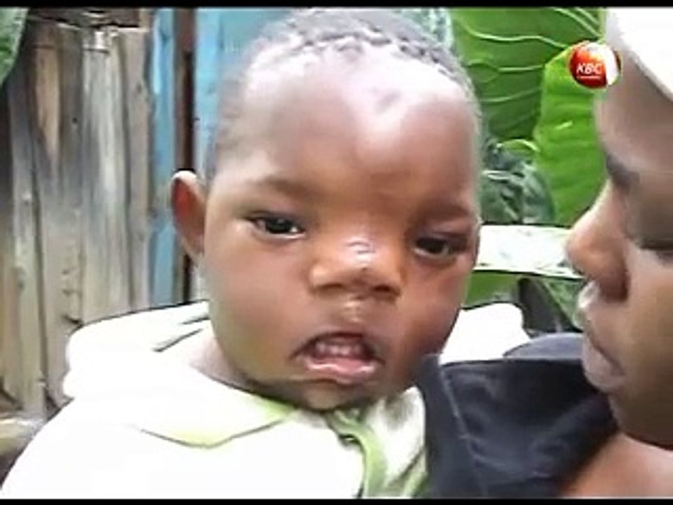 Woman suffers from giving birth to disabled child