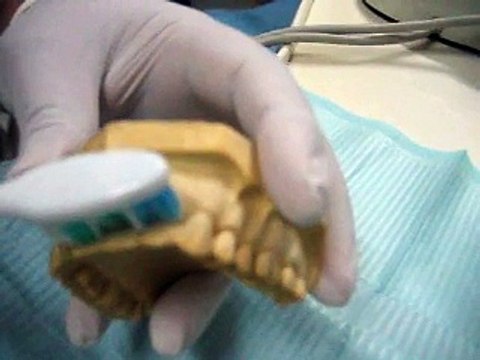 Mumtaz tooth brushing technique (an easy and effective tooth brushing technique)