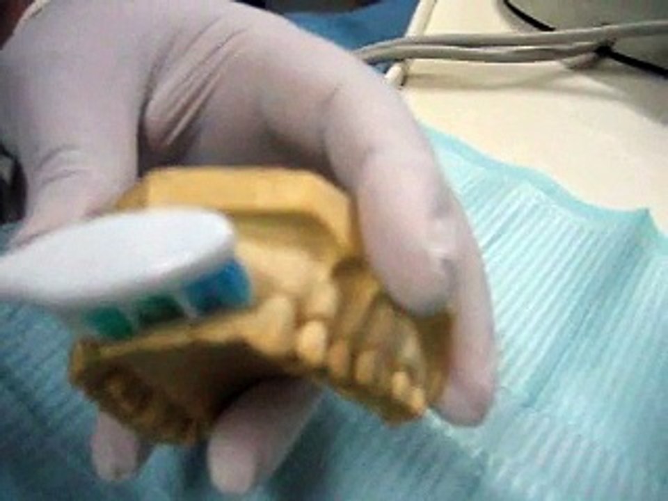 Mumtaz tooth brushing technique (an easy and effective tooth brushing technique)