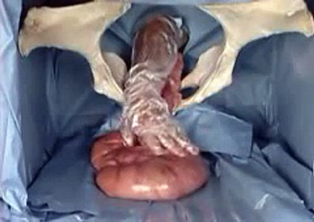 Rectal palpation technique for a pregnant cow .
