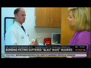 Challenges for Amputees in Boston bombing