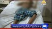 Dunya News - Implacable feudal attempts to scorch 10-yr-old minor in Sheikhupura