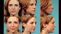 Dr Mentz Facial Rejuvenation