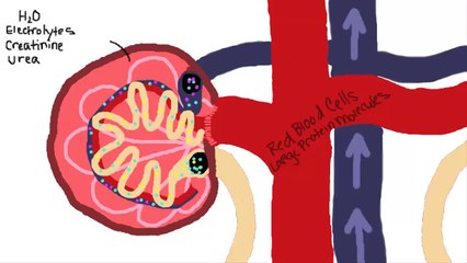Chronic Kidney Disease