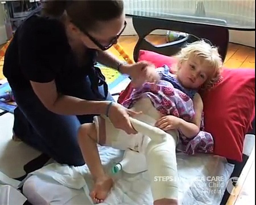 Hip Spica-Older-Child-Toileting.mp4