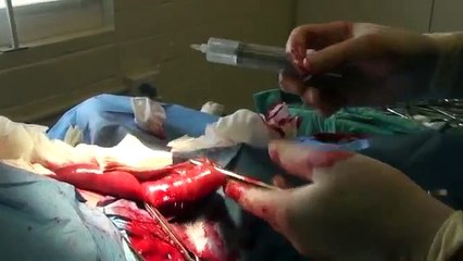 Dog Ate a Big Rock :Blocked Intestine