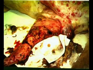 The Awful Reality: Pitbull Fighting & Animal Abuse