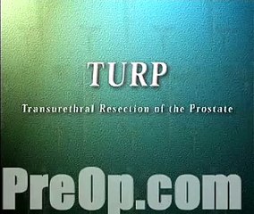 TURP Transurethral Resection Prostate via Penis Surgery