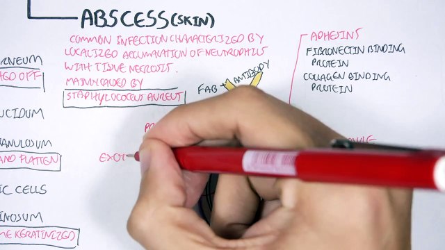 Microbiology - Staphylococcus Aureus and Skin Abscess